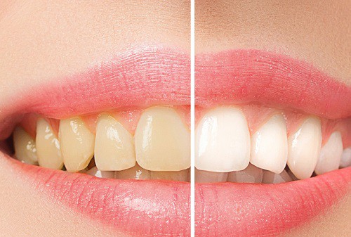 חשוב לתת ערך קידום בפייסבוק לרופא שיניים